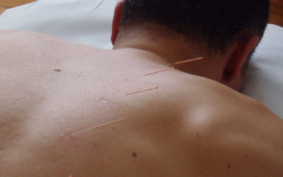 Giornata nazionale dell’Agopuntura