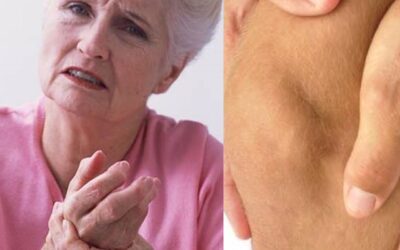 Curare l’artrosi delle articolazioni con la medicina naturale