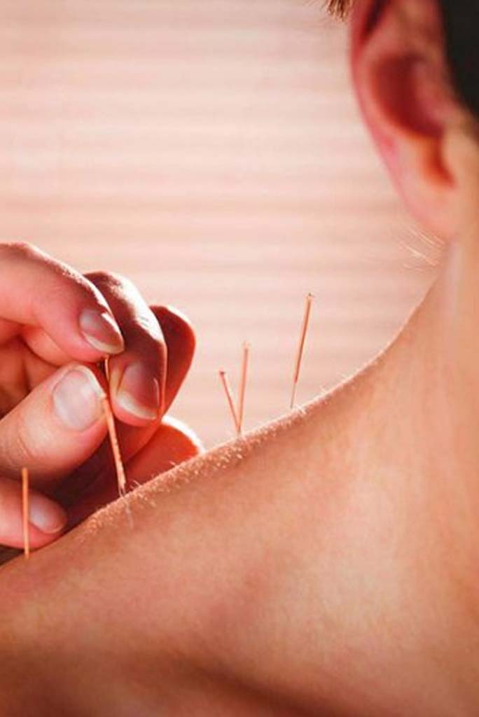 agopuntura indicazioni terapeutiche agopuntura indicazioni terapeutiche